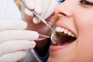 Dental Insurance in Fargo, Moorhead, ND.